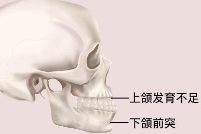 地包天的图片
