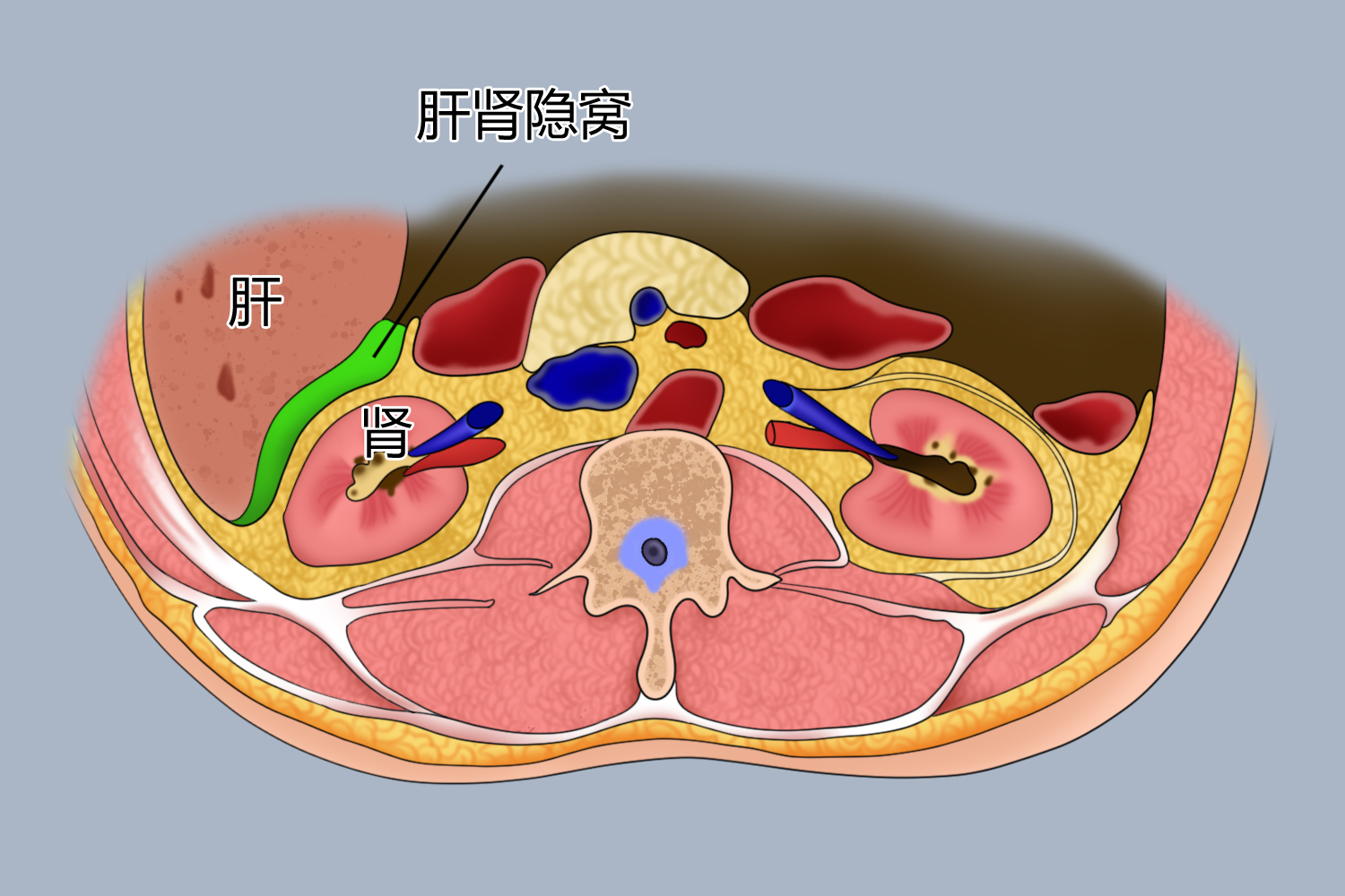肝肾隐窝位置图 | 百度健康·医学科普