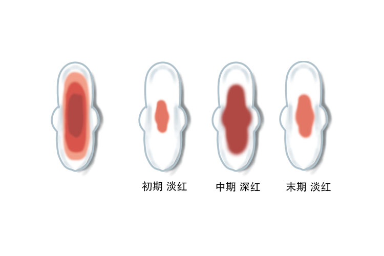 什么样的月经血是正常的图片 | 百度健康·医学科普