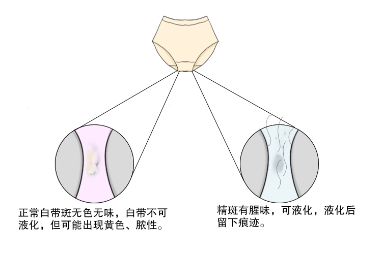 白带斑和精斑图片区别