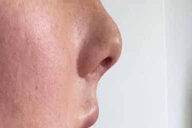 各种鼻型图片介绍