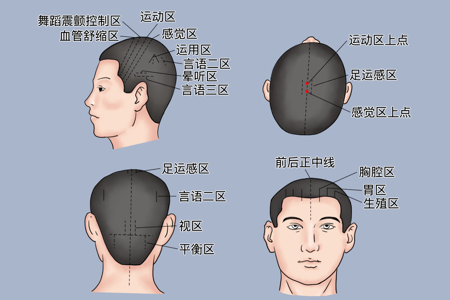 焦氏头皮针分区图