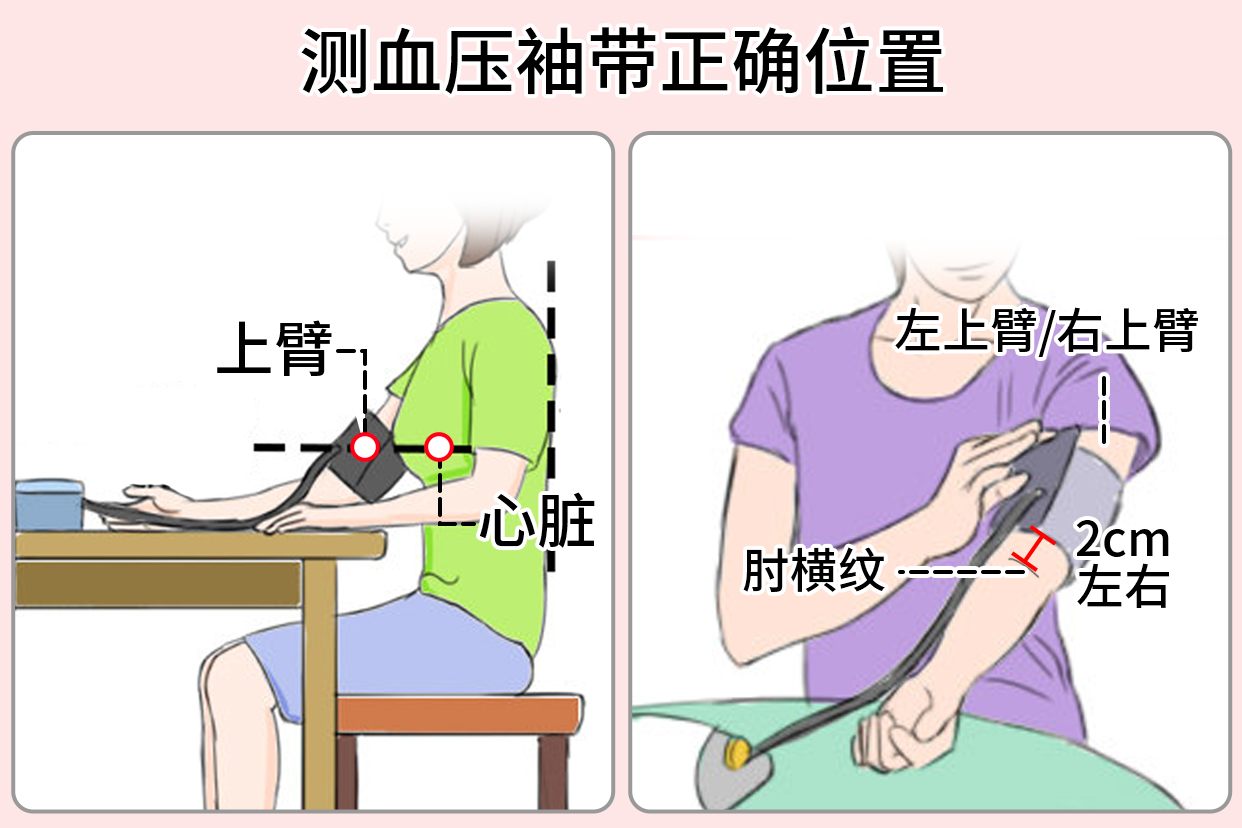 测量血压袖带位置 | 百度健康·医学科普