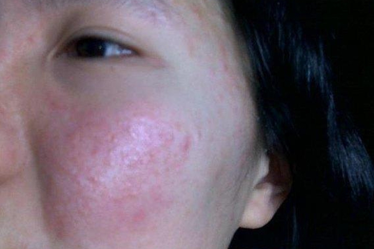 开云体育- 开云体育官方网站- 开云体育APP 最新2025用护肤品过敏的症状有哪些