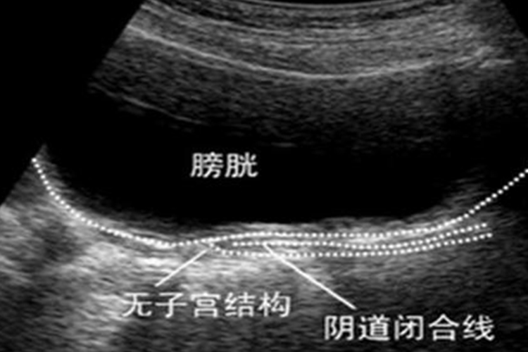 怎么知道自己是石女图片