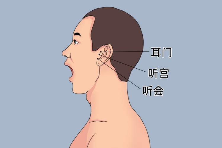神经性耳鸣的针灸穴位 | 百度健康·医学科普
