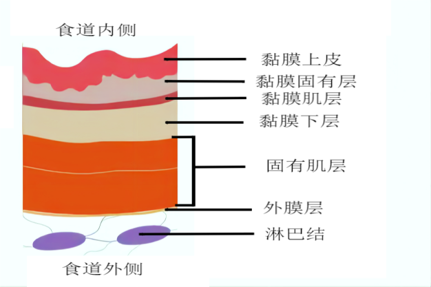 食管结构图片