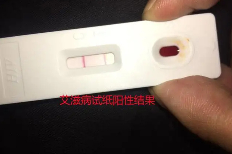 hiv试纸检测图片 | 百度健康·医学科普