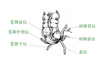 阑尾尖端指向六种类型图解