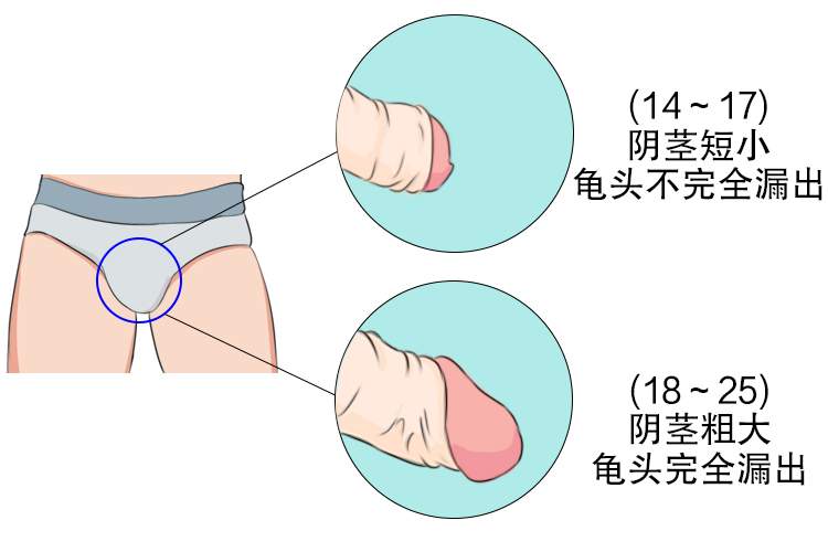 龟头形状图