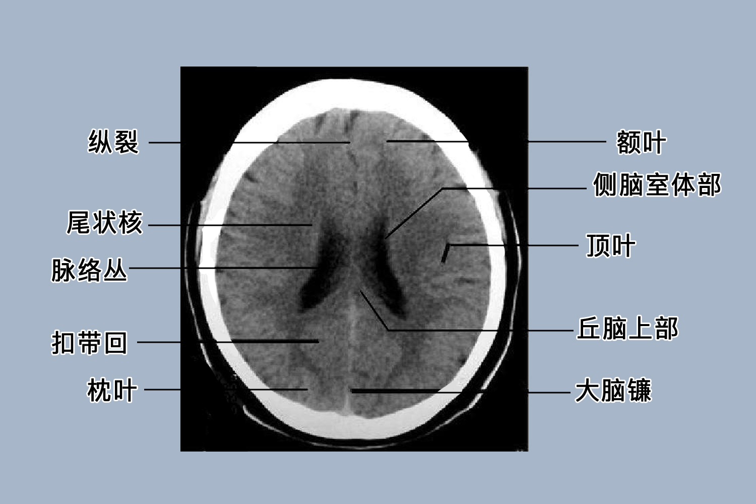 头颅ct详细解剖图 | 百度健康·医学科普