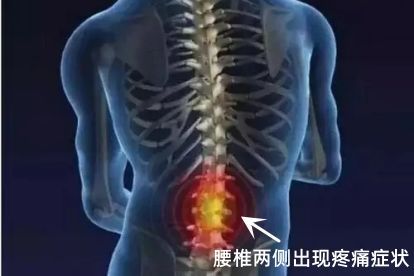 后背疼痛位置图片