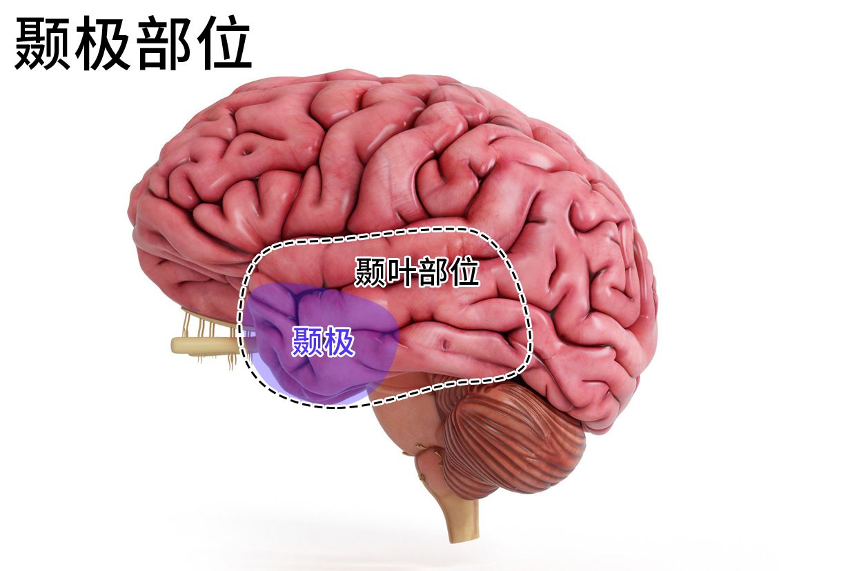 颞极是什么部位图
