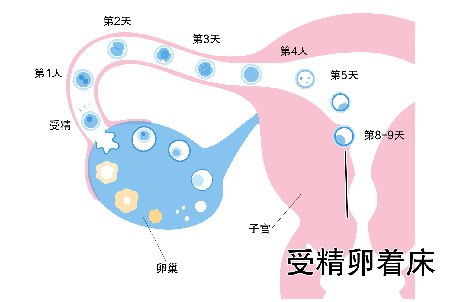 受精卵着床位置