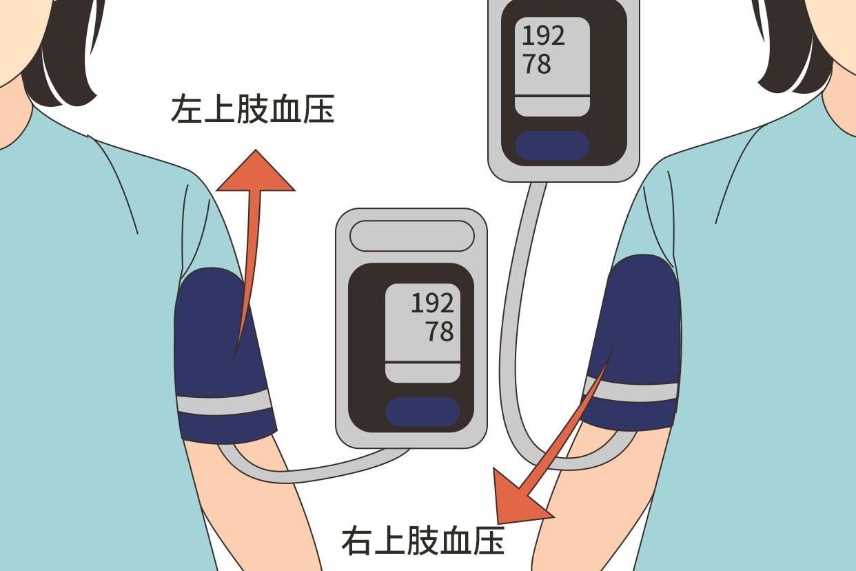 量血压图片 | 百度健康·医学科普