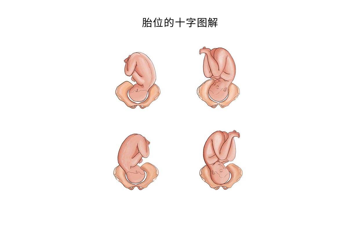 胎位的十字图解
