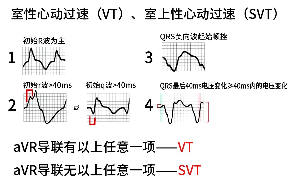 室上速和房速心电图怎么鉴别 | 百度健康·医学科普