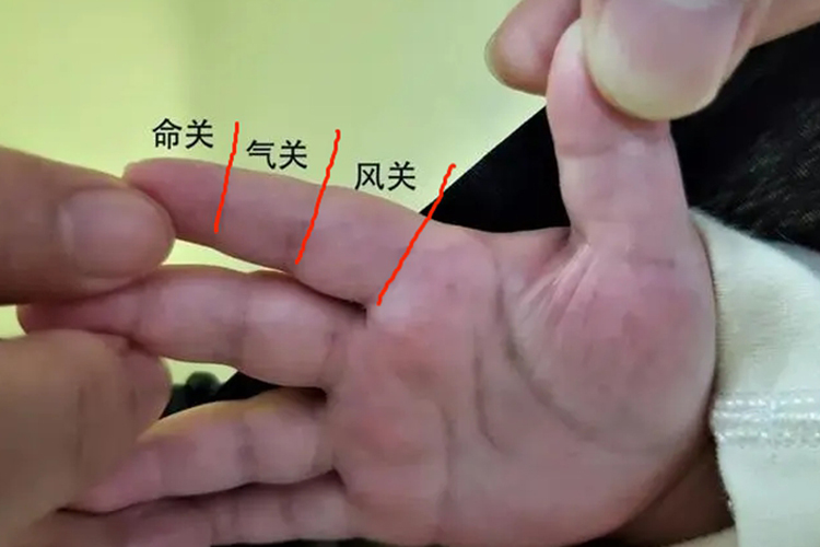 小儿食指络脉图片