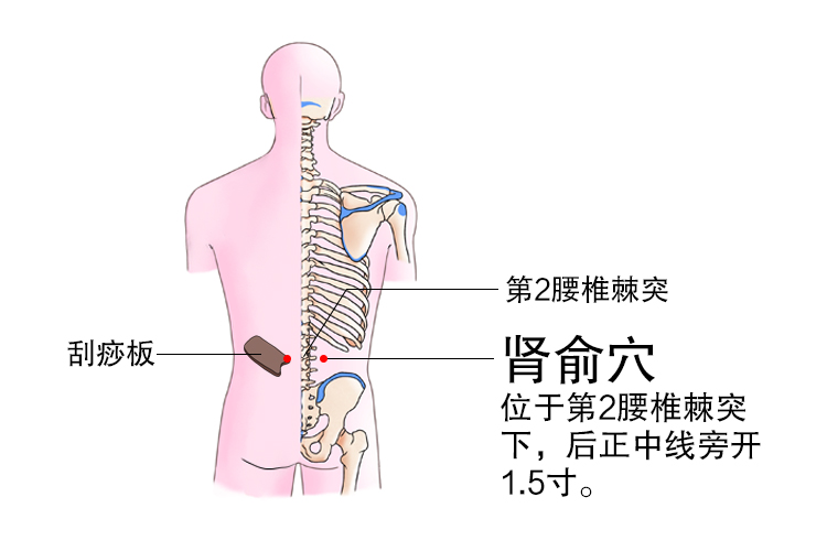 中医背部刮痧示意图 | 百度健康·医学科普