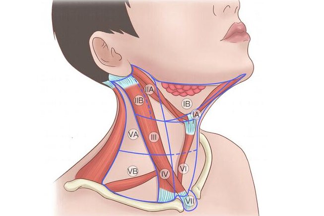 颈部淋巴结位置图