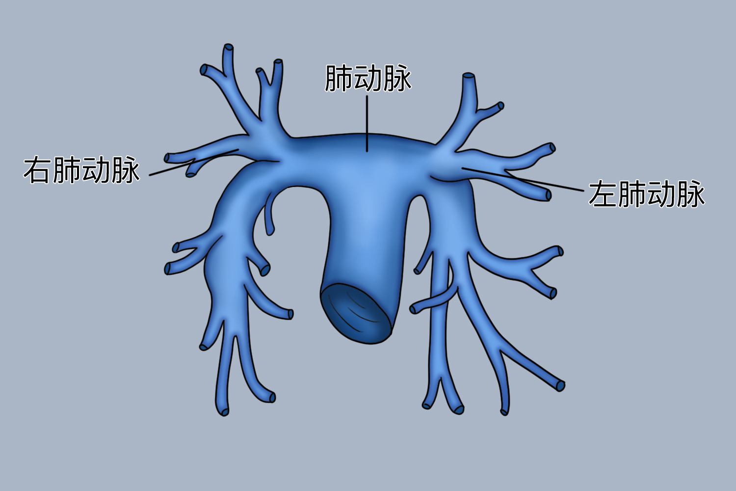 肺动脉图