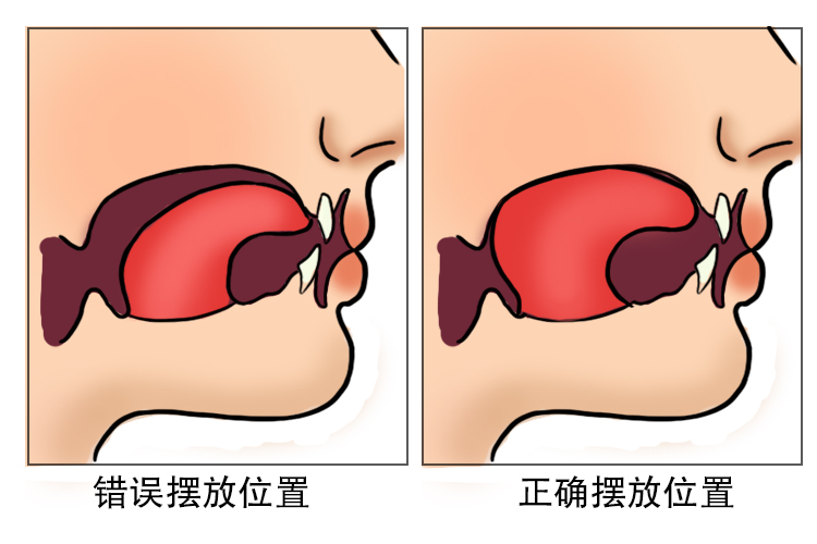 舌头平时正确摆放位置图片