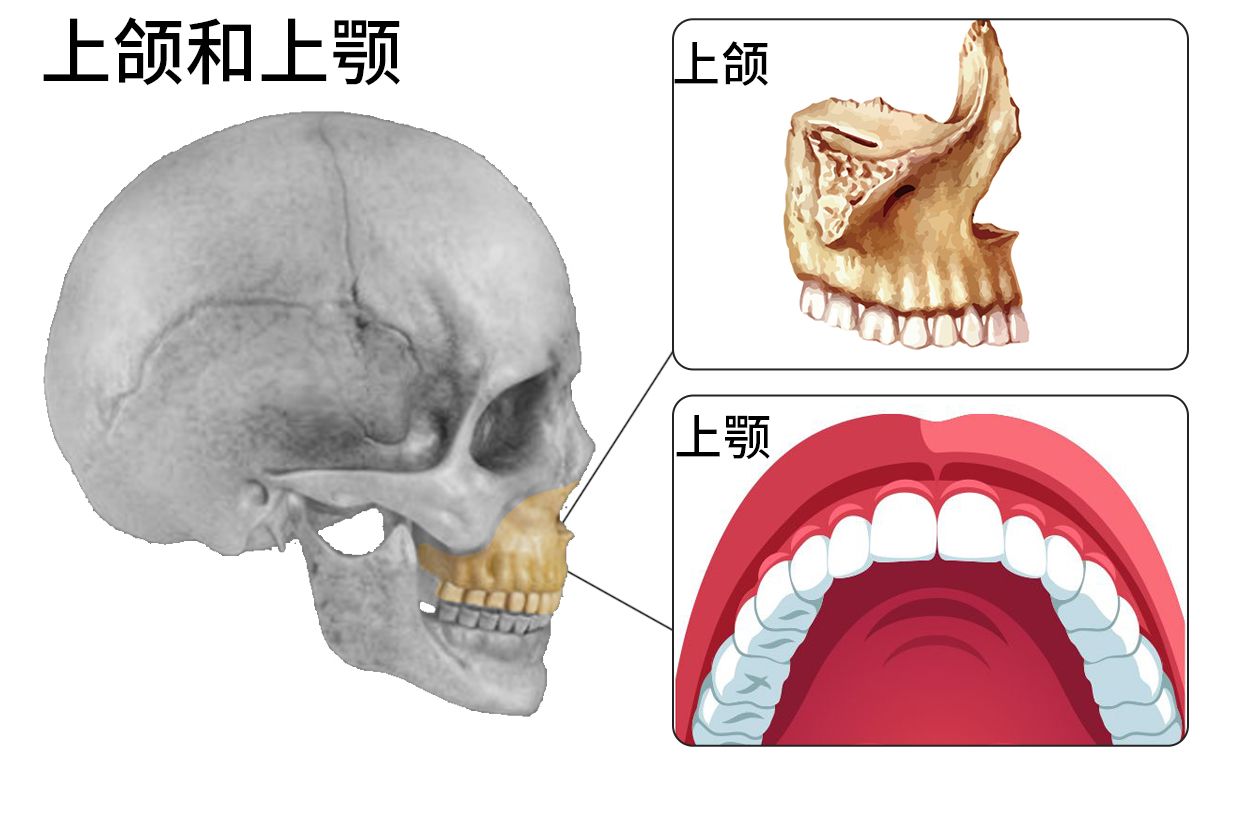 上颌和上颚的图片