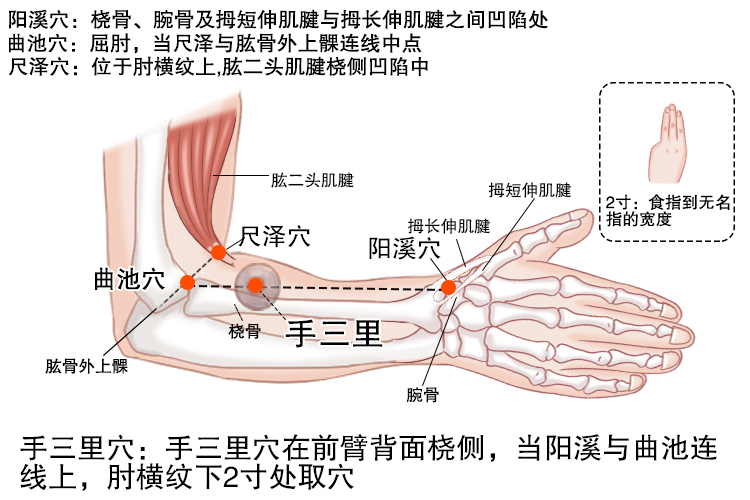手痛拔罐拔图