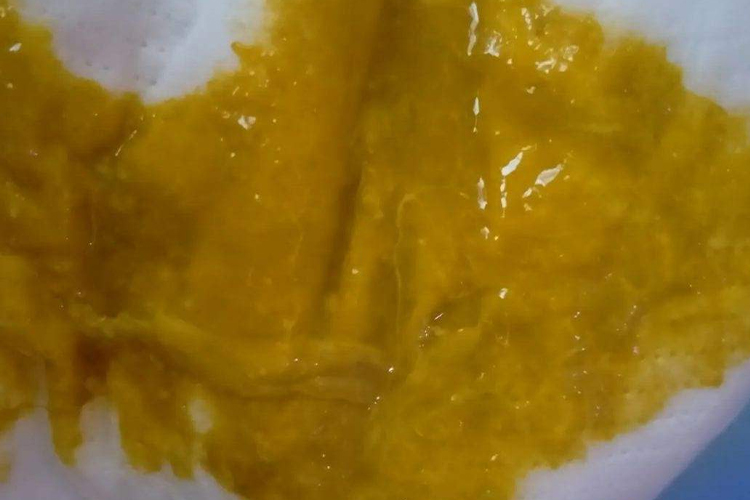 婴儿大便粘稠糊状图片