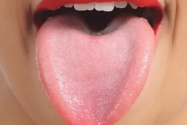 正常舌苔图