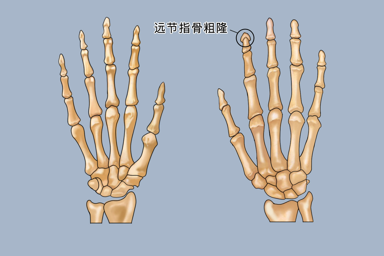 远节指骨粗隆图片