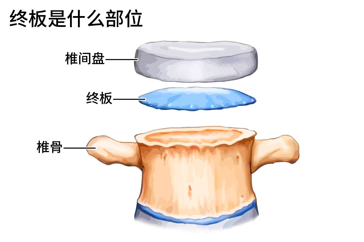 终板是什么部位图片