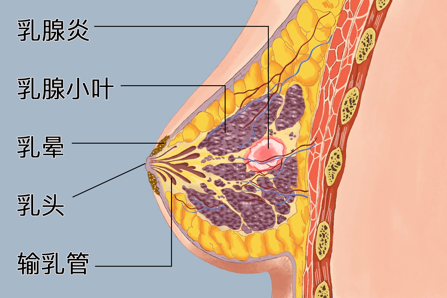 乳腺炎的隐痛部位图