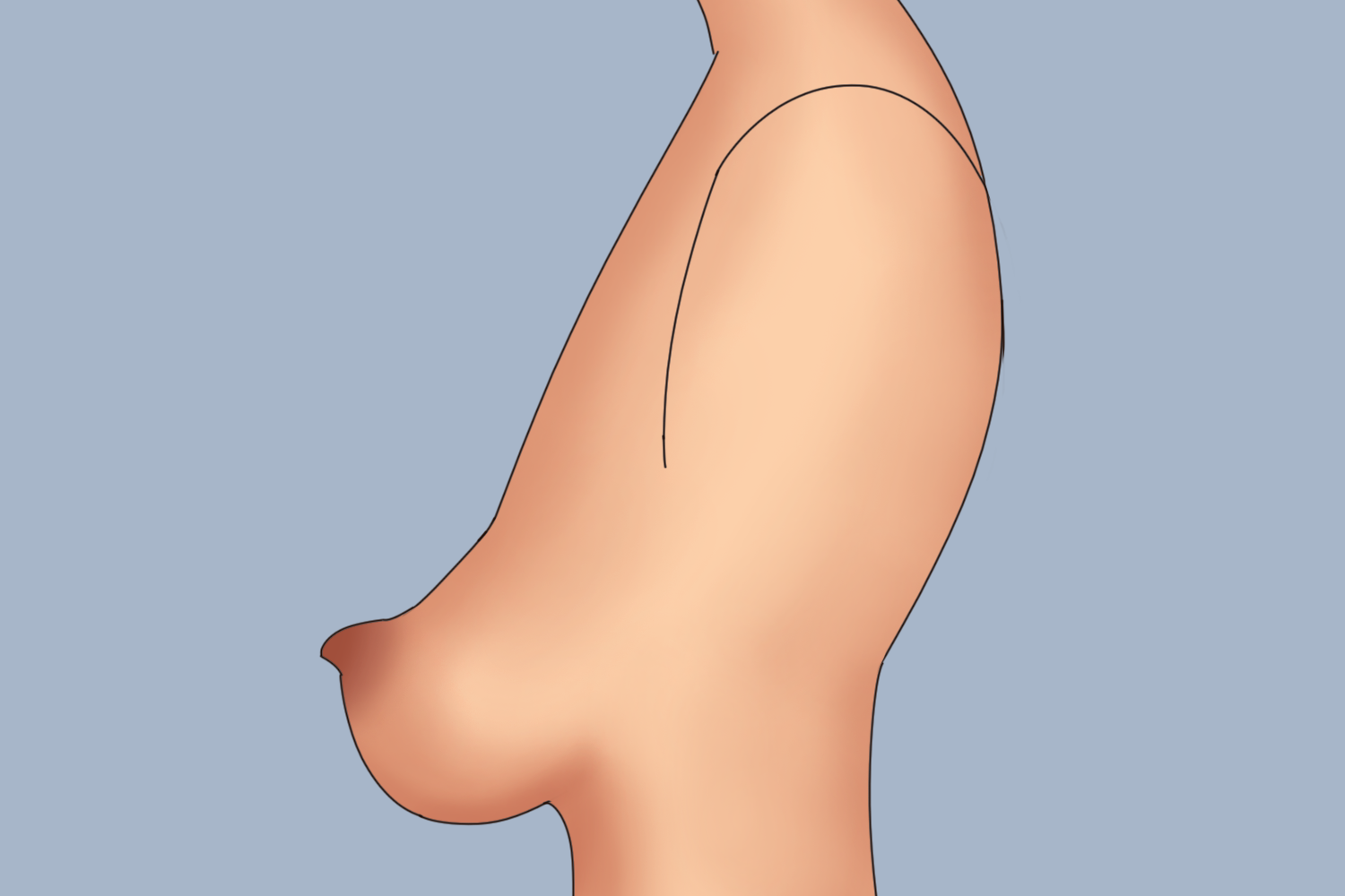 下垂型乳房图