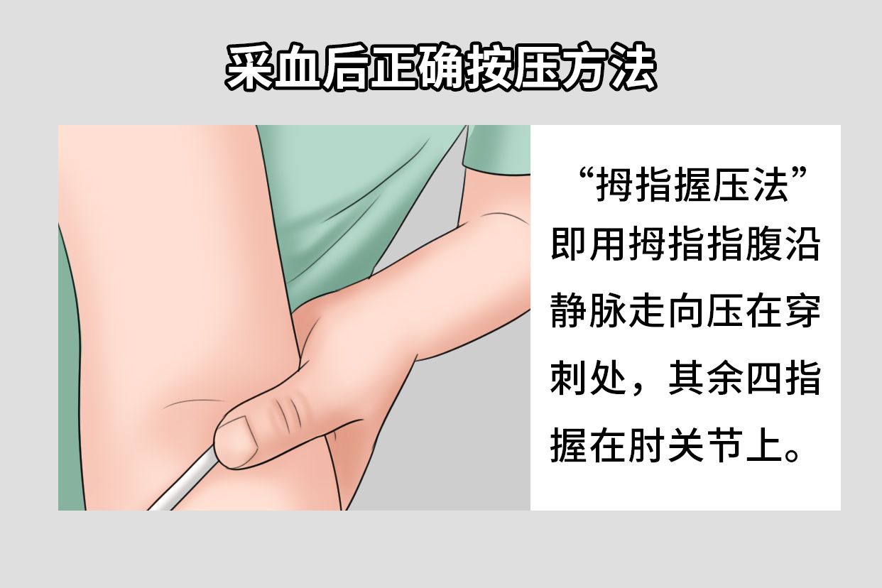 采血后正确按压方法图片 | 百度健康·医学科普