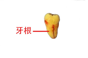 各个牙齿的牙根图片 | 百度健康·医学科普