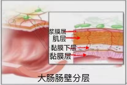 大肠肠壁分层图