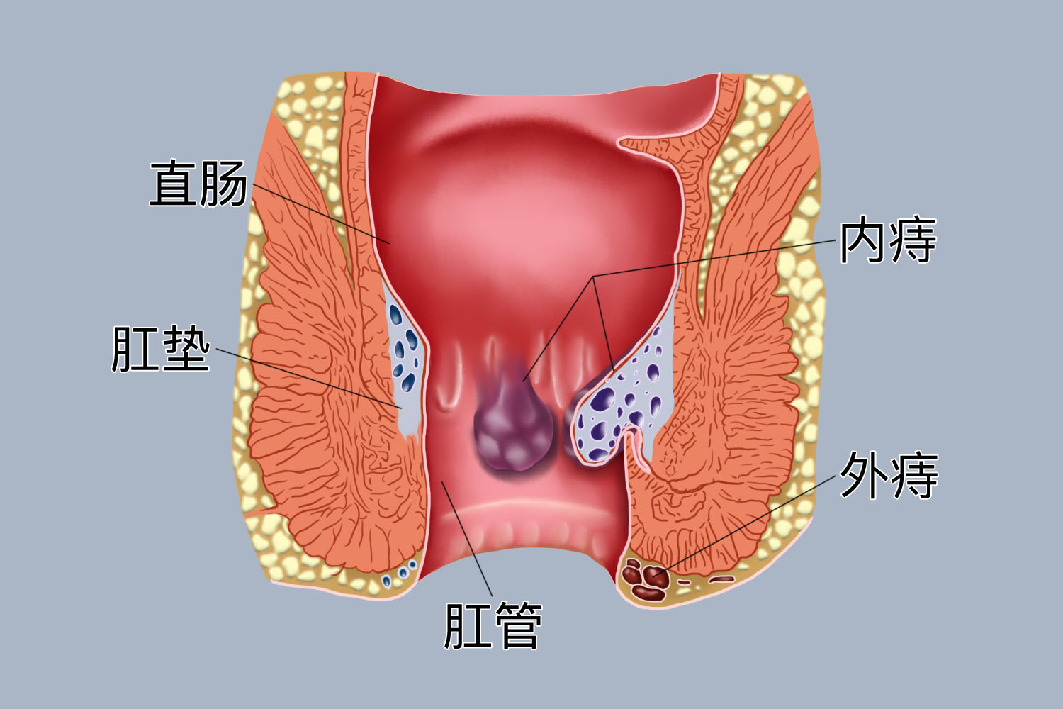 肛垫的位置图