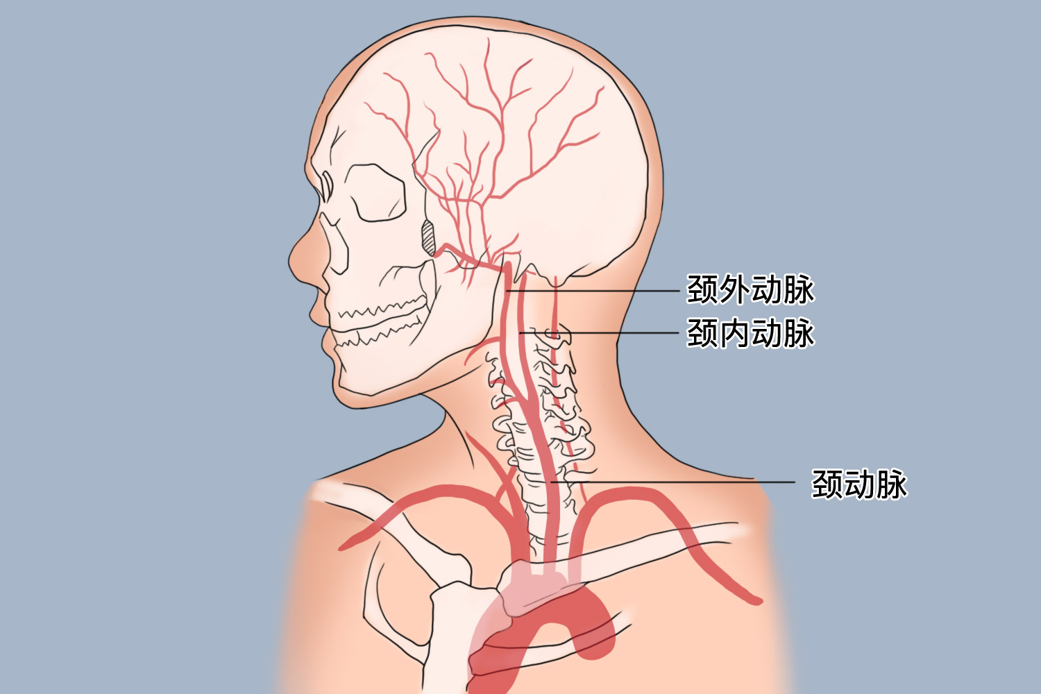 颈动脉图