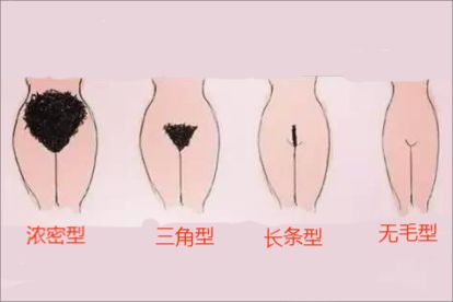 女性阴毛分布图