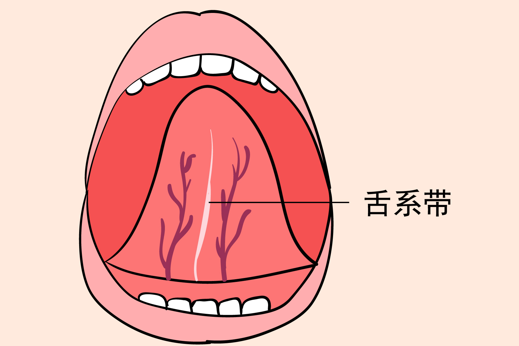 舌头下面两边发紫发黑图片