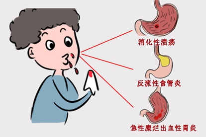 吐血是什么原因引起的图片