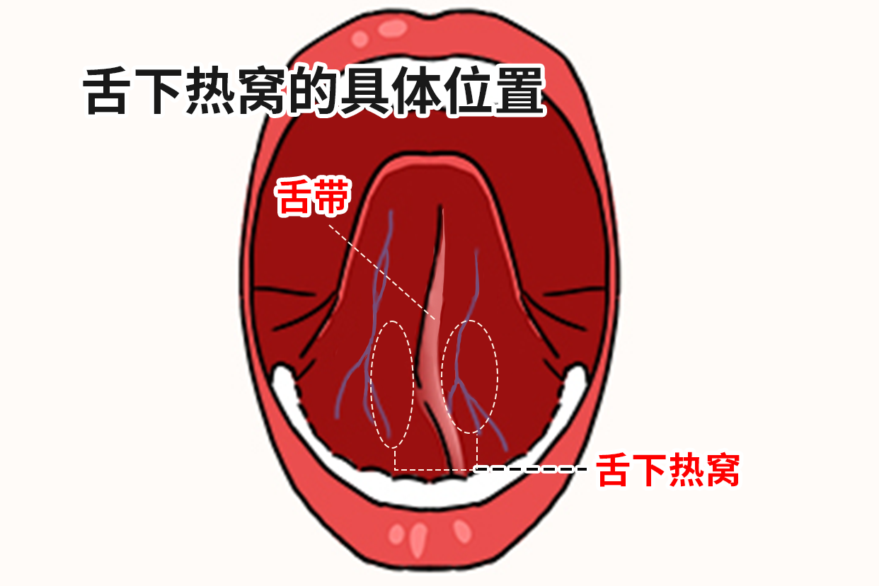 舌下热窝的具体位置图片