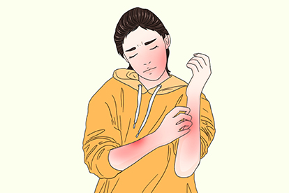 晒伤是什么样子图片 | 百度健康·医学科普