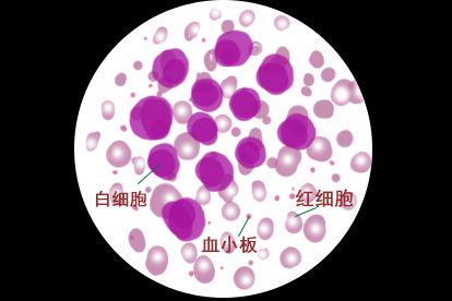 血涂片细胞形态图片及名称 | 百度健康·医学科普
