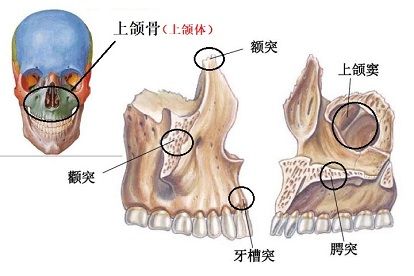 上颌骨一体四突图片