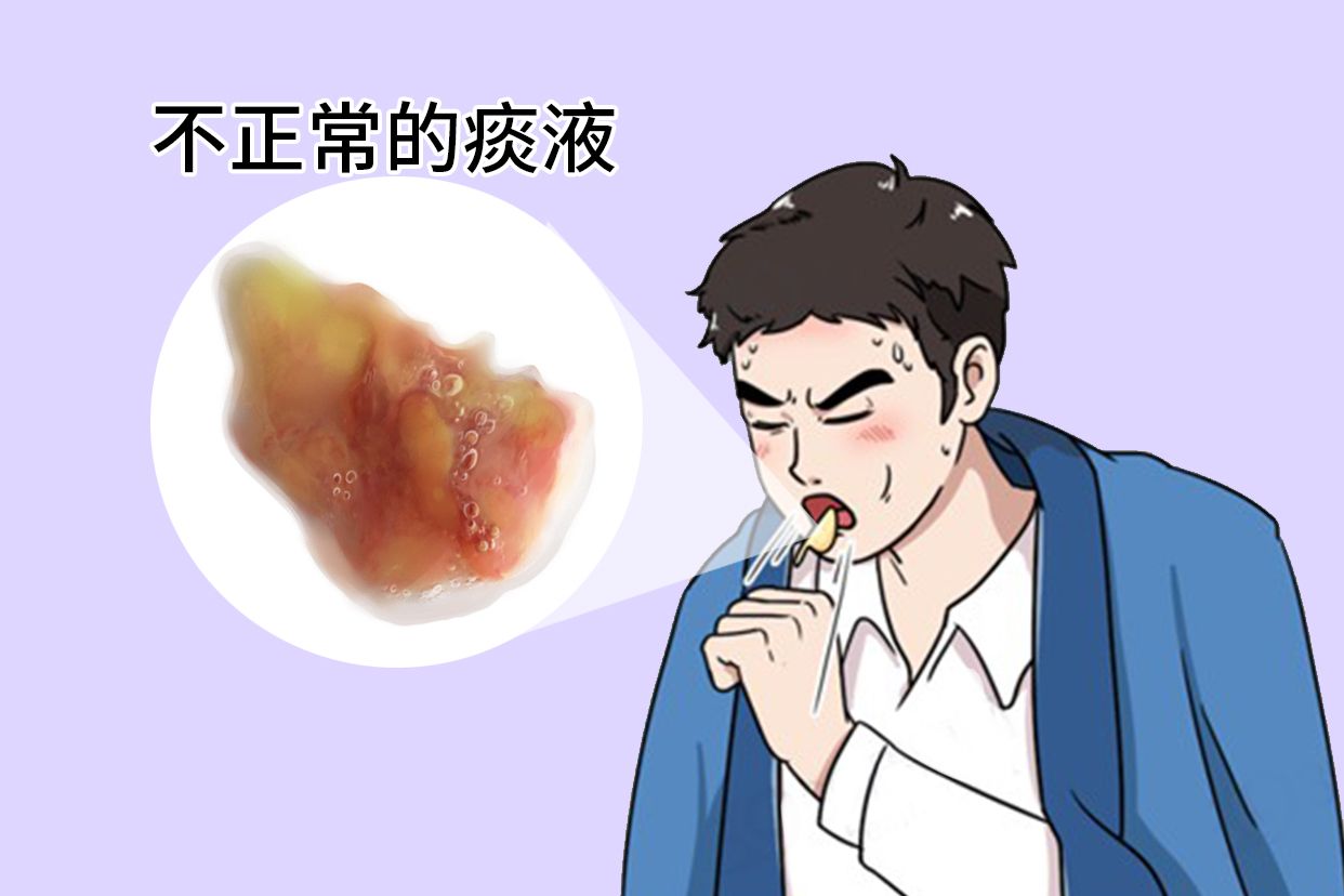 不正常的痰液图片