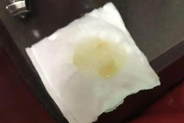 咳嗽出一坨一坨的黄痰的图片