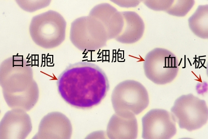 红细胞,白细胞,血小板 示意图 | 百度健康·医学科普