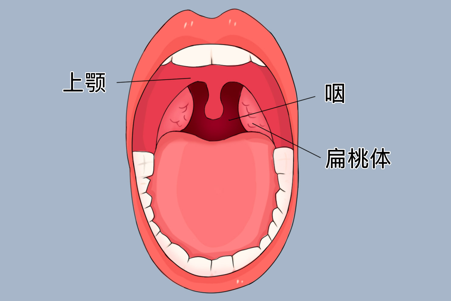 正常扁桃体图